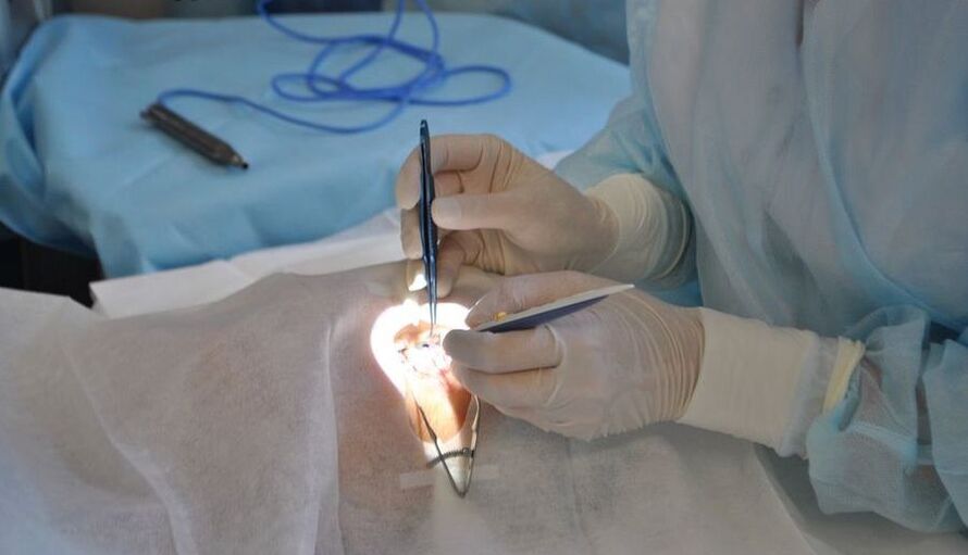 Eye surgery to help restore vision.
